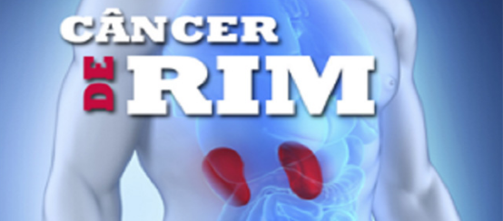 Câncer de rim: especialista alerta que tumor é duas vezes mais comum em homens do que nas mulheres 