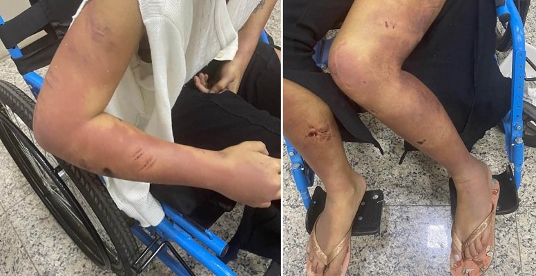 Tentativa de feminicídio: mulher agredida acreditou que namorado iria mudar, diz delegado