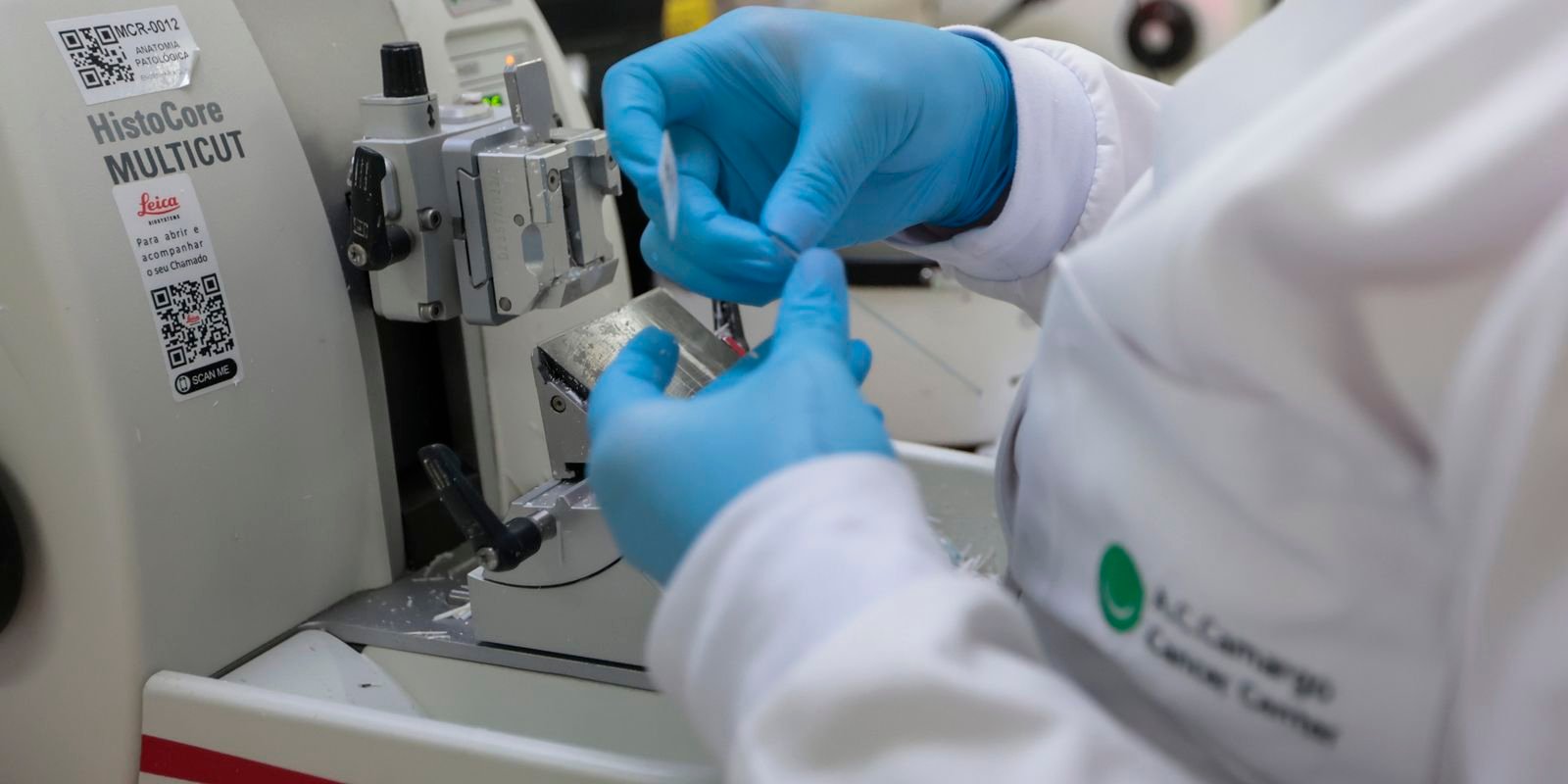 Câncer de Próstata: Chance de Cura Alcança 98% Com Diagnóstico Precoce