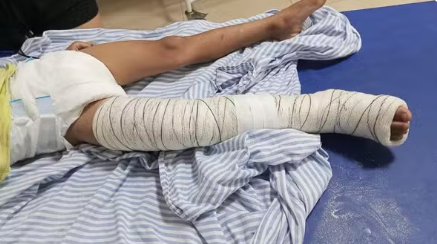 Criança de 5 anos é atropelada por motociclista que fugiu sem prestar socorro em Ilha Solteira