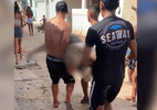 Ataque de Tubarão em Olinda Fere Adolescente e Acende Alerta nas Praias do Grande Recife