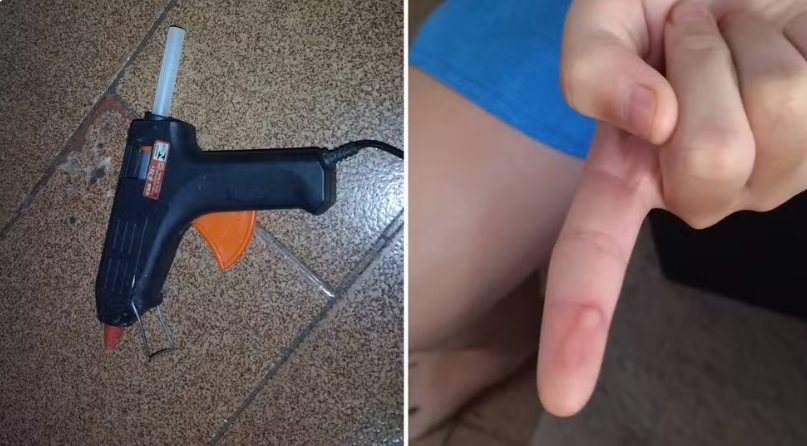 Mães denunciam professora suspeita de queimar alunos com cola quente durante aula de artes em escola