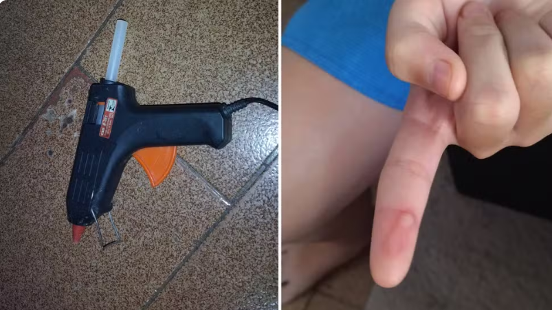 Pai relata medo do filho em voltar a escola de Birigui onde foi castigado com cola quente na aula