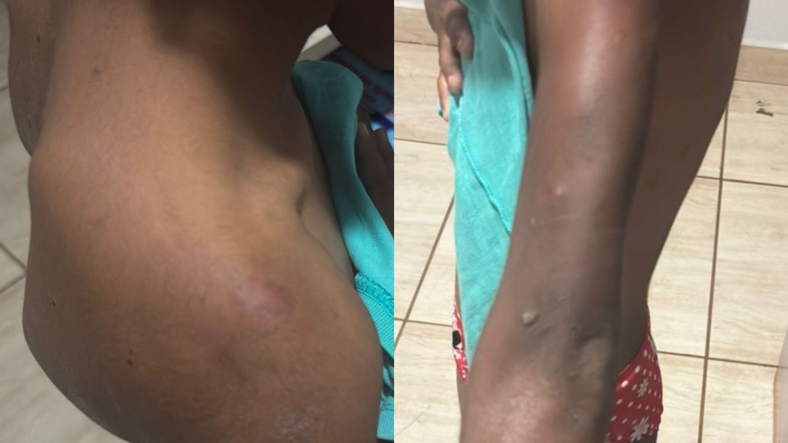 Casal é preso em Riolândia acusado de torturar sobrinha de 12 anos por um ano; delegado aponta ‘diversos estágios de cicatrização’ em lesões