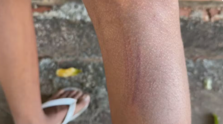 Adolescente diz à polícia ter sido agredido por segurança de mercado em Tanabi