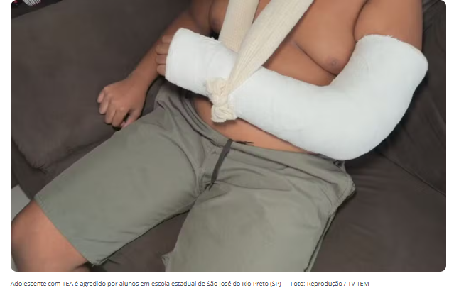 Adolescente autista tem braço quebrado ao ser agredido por alunos em escola do Jardim Antunes