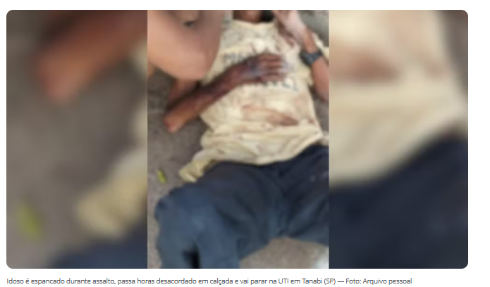 Idoso é espancado em assalto após ladrões invadirem casa em Tanabi