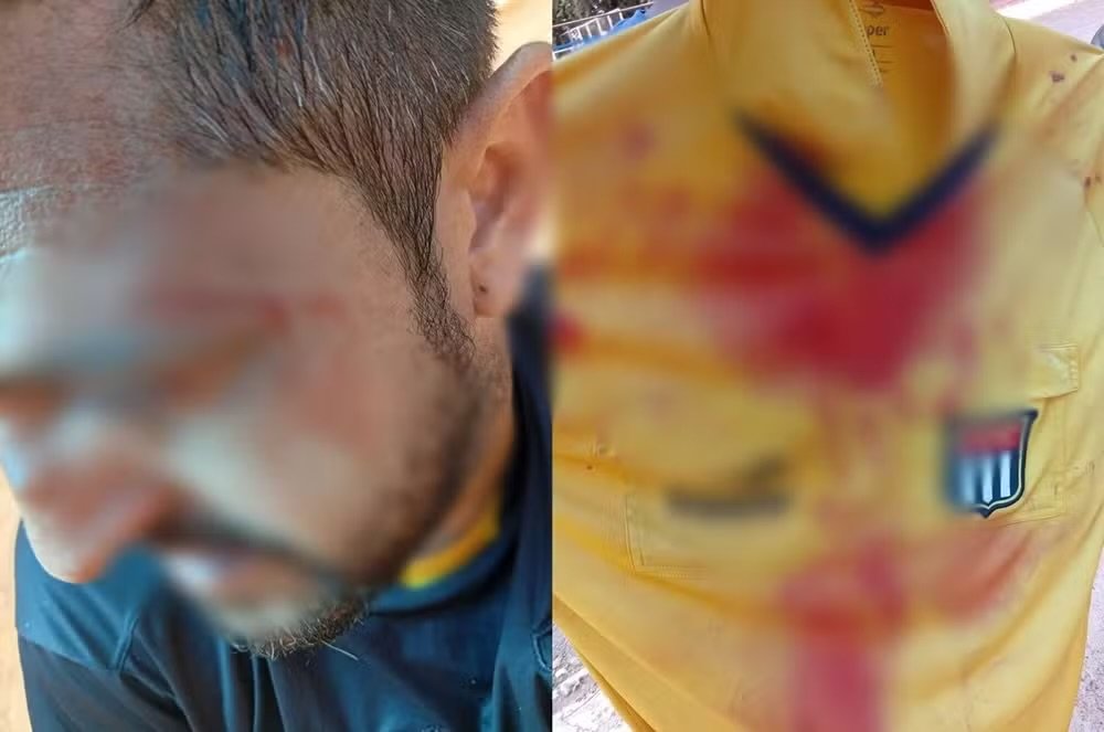Árbitro é agredido por pais e jogadores em jogo sub-14 em Cstanduva