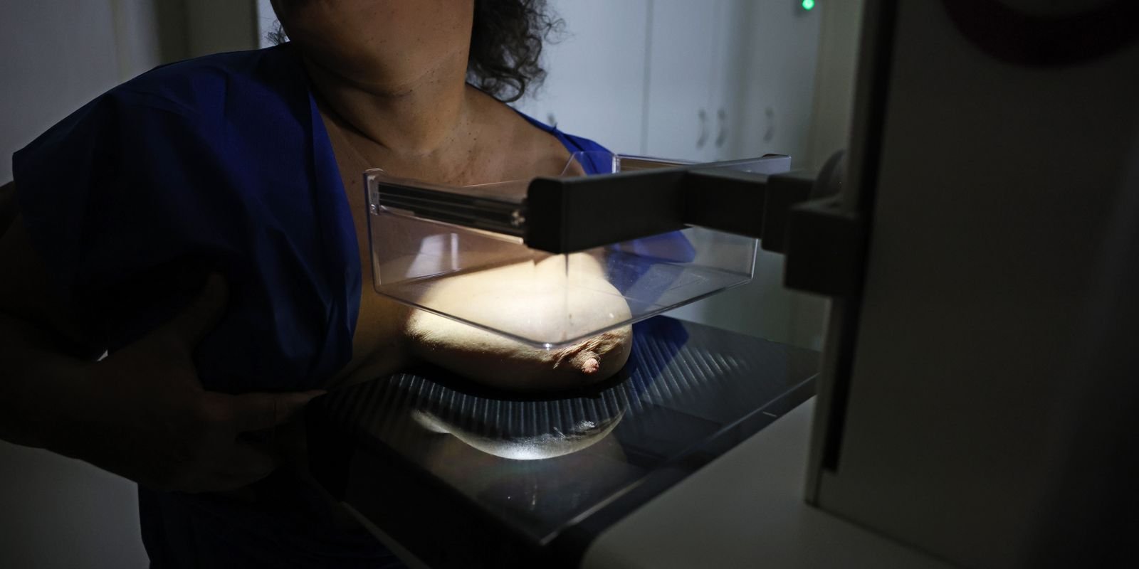 ANS avança para universalizar mamografia digital em planos de saúde: fim das restrições de idade e gênero