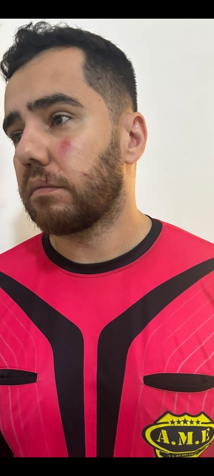 Ex-jogador do Palmeiras e Grêmio é acusado de agredir árbitro durante a Copa AME em Rio Preto
