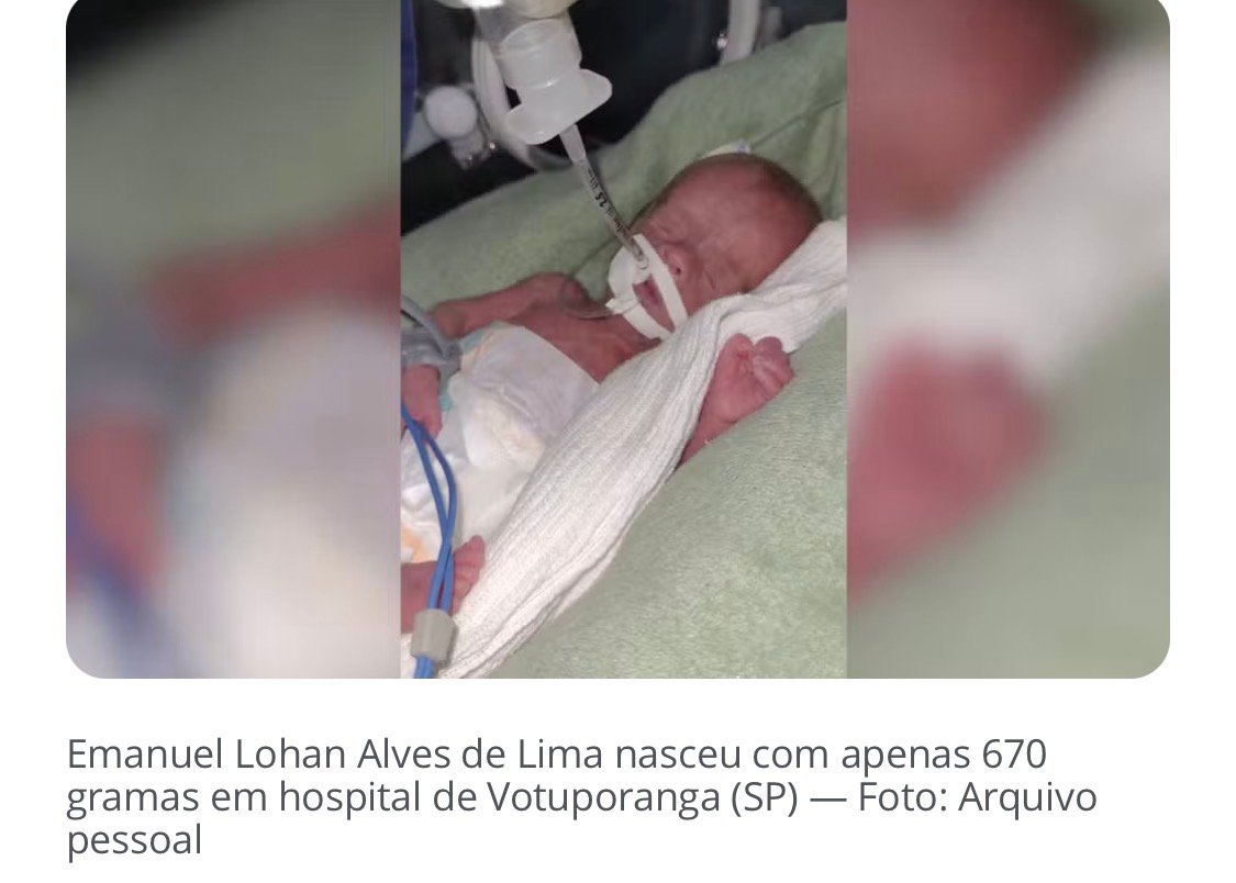 Menino de 3 anos luta contra avanço da escoliose após nascer com 670 gramas