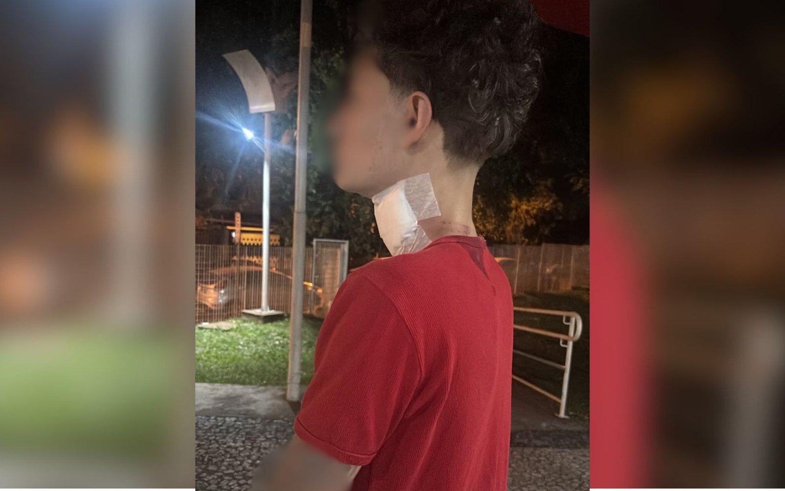Motociclista gravemente ferido por linha com cerol em Rio Preto expõe perigo invisível nas ruas