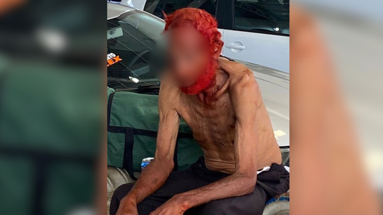 Empresário é processado por tingir cabelos e barba de idoso em situação de rua