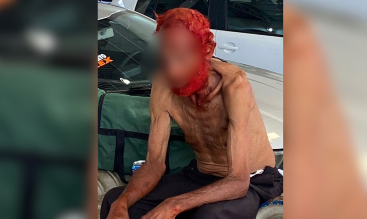 Empresário é processado por tingir cabelos e barba de idoso em situação de rua