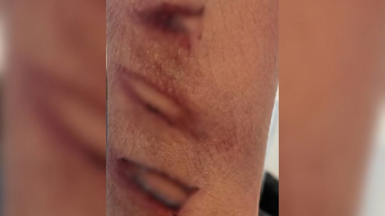 Homem é preso por maus-tratos após espancar enteado com pedaço de mangueira
