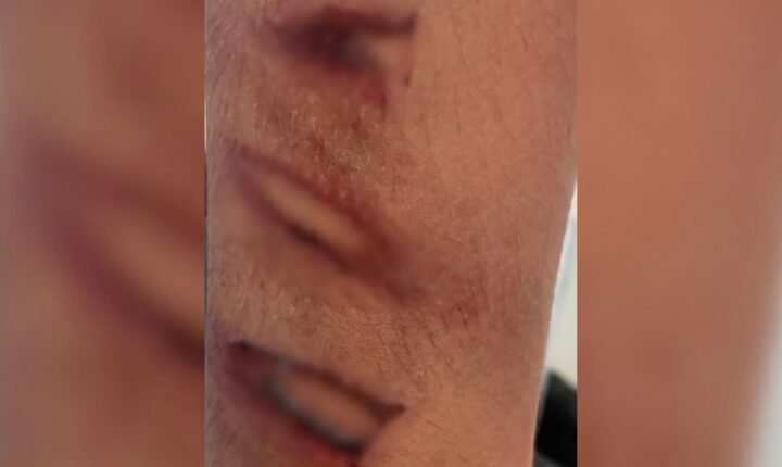 Homem é preso por maus-tratos após espancar enteado com pedaço de mangueira