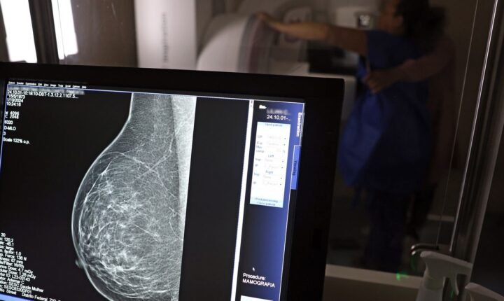 Entidades alertam médicos sobre pedidos de mamografia digital
