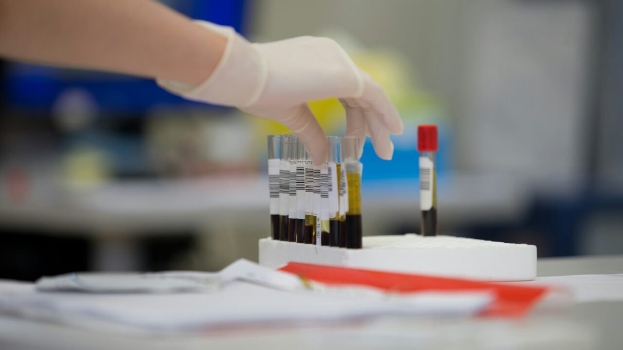 Exame de sangue que pode detectar 50 tipos de câncer chega ao Brasil; veja como funciona
