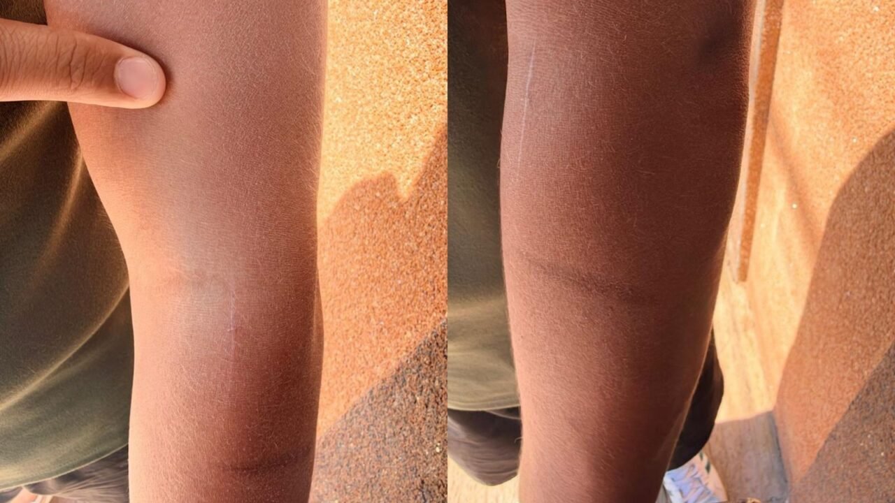 Adolescente é agredido por dois alunos em escola municipal no interior de SP