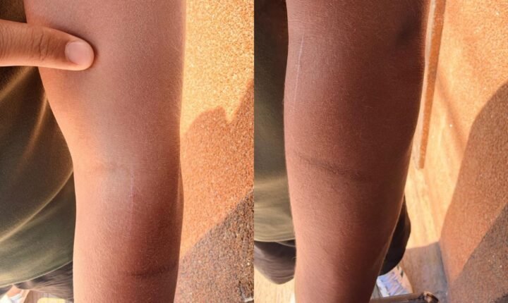 Adolescente é agredido por dois alunos em escola municipal no interior de SP